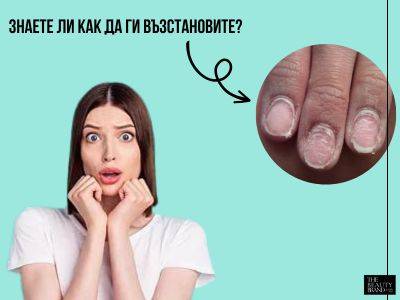 ВИЖДАЛИ ЛИ СТЕ ПОДОБНИ НОКТИ? А ЗНАЕТЕ ЛИ КАК ДА ГИ ВЪЗСТАНОВИТЕ?